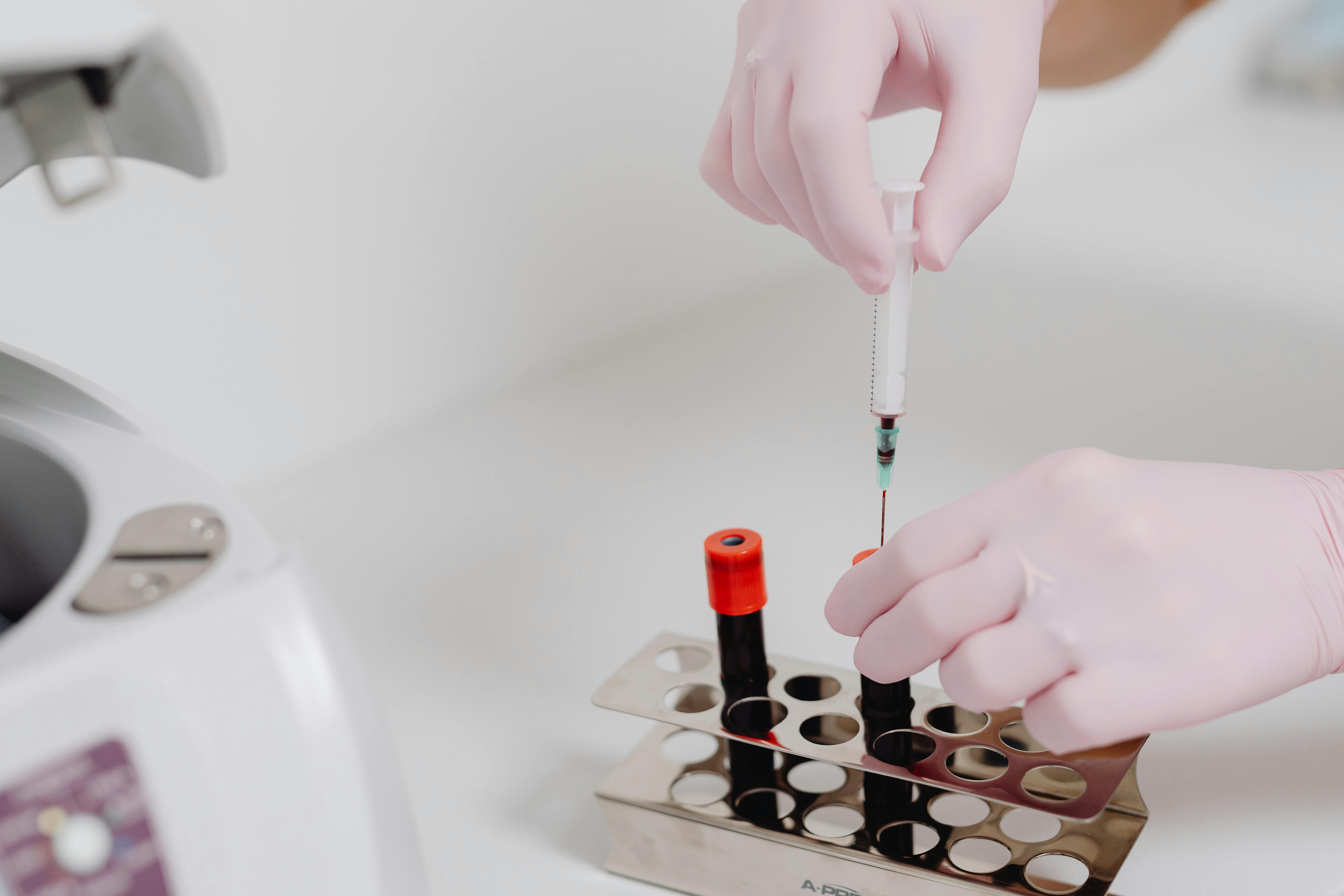 X-Rays & Blood Tests at Home: How Mobile Diagnostics Work